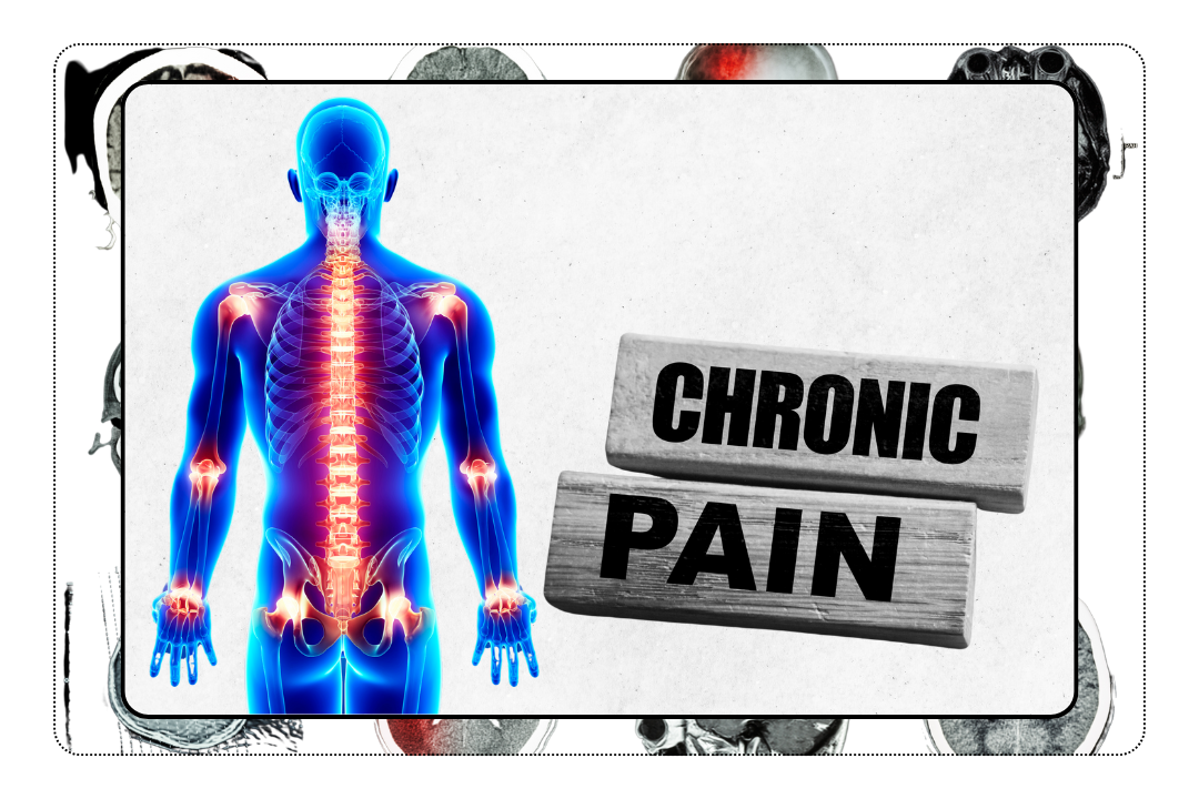 Chronic Pain
